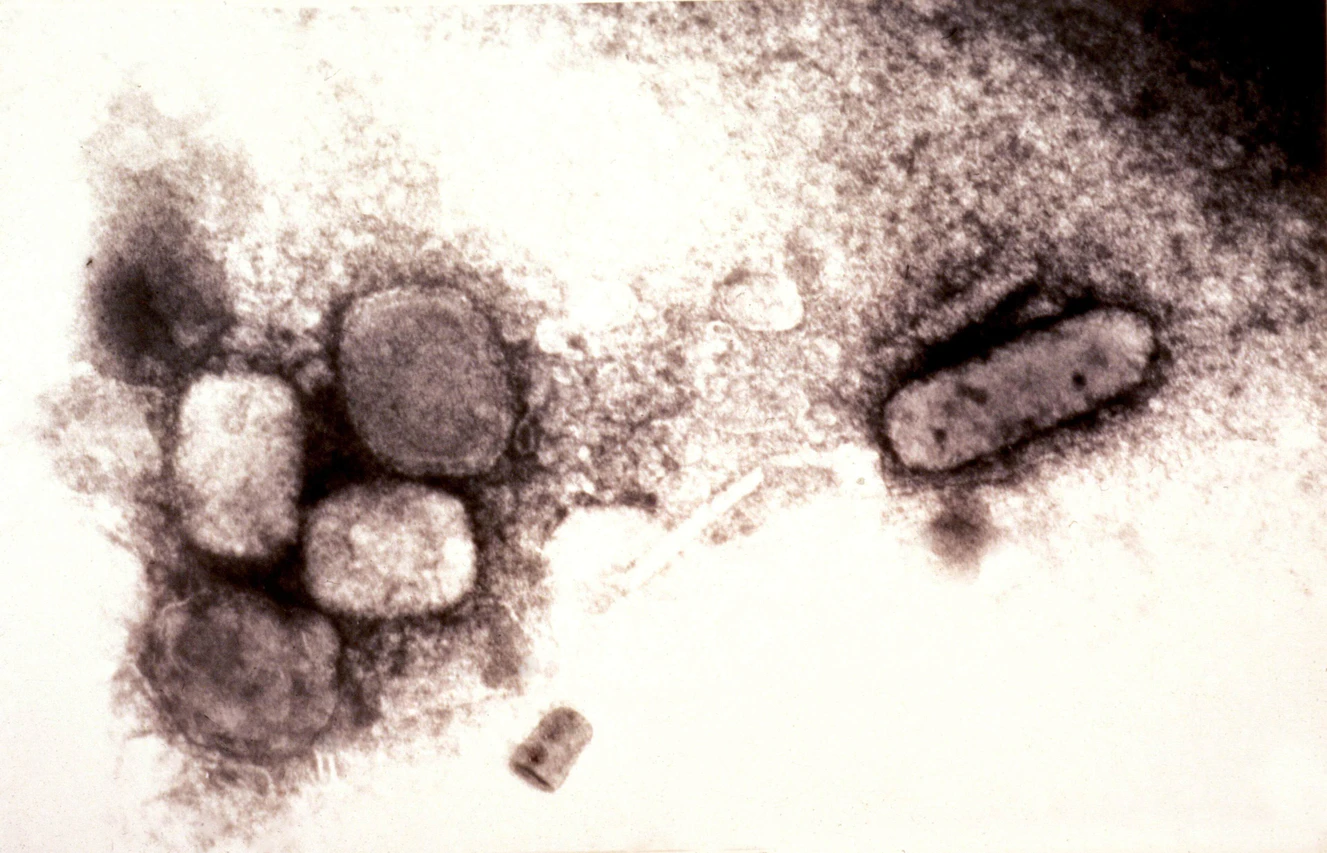 mikroskopische Aufnahme, Variola, Pocken, Virus, Vergrößerung