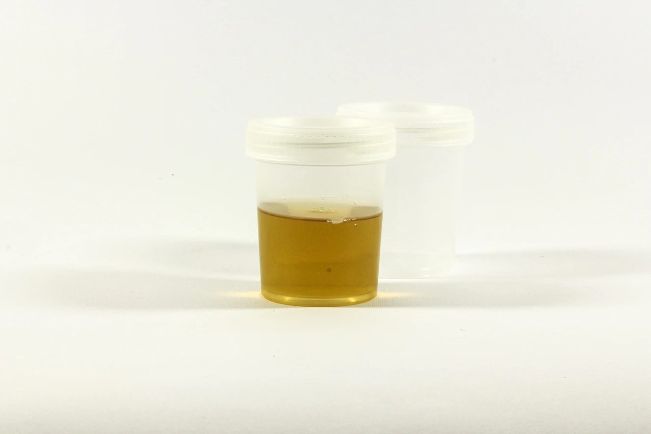 Urinprobe