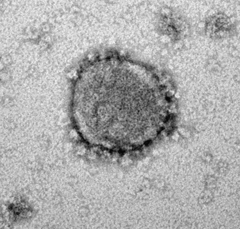 Coronavirus unter dem Mikroskop — © Dr. Clarissa Read/Uni Ulm